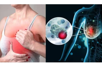மார்பக புற்றுநோய் - மாதவிடாய் முடிந்த ஒரு வாரத்தில் .. பெண்களே எச்சரிக்கை!