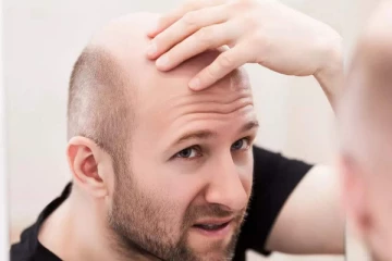 சொட்டை தலையில் கூட முடி வளரனுமா? இதோ அசத்தலான டிப்ஸ்