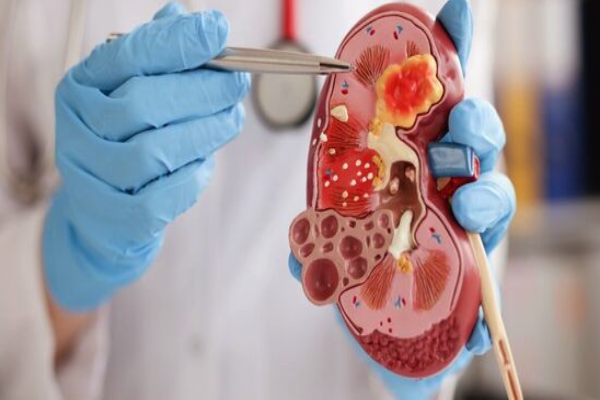 சிறுநீரகத்தை சீரழிக்கும் பானங்கள் - இதை எல்லாம் குடிக்காதீங்க | Drinks That Affect The Kidneys Urologist Reveals