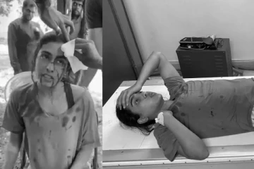 சம்யுக்தா ஹெக்டே சண்டைக்காட்சியில் படுகாயம்! வலியால் துடித்த நடிகை