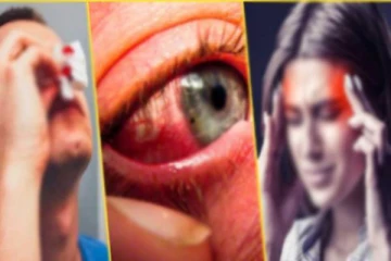 கறுப்பு பூஞ்சை நோய் தொடர்பில் விடுக்கப்பட்டுள்ள அவசர எச்சரிக்கை