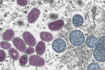 ලොව පුරා වේගයෙන් ව්‍යාප්ත වන වඳුරු උණ ගැන ඔබ දැනුවත්ද?