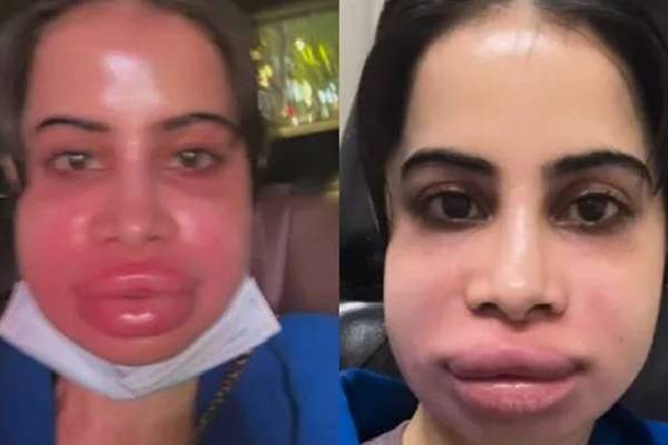 பாலிவுட்டில் பிரபலமாக நினைத்த பெண்ணுக்கு நேர்ந்த கதி | Fate Woman Thought To Be Famous In Bollywood