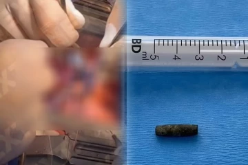 உக்ரைன் வீரரின் இதயத்தில் பாய்ந்த குண்டு... குணமடைந்தபின் அவர் சொன்ன வார்த்தைகள்