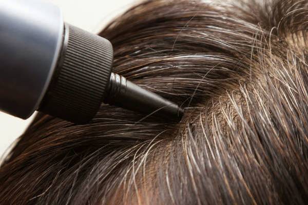 முடி நரைக்க என்ன காரணம் தெரியுமா? இதை உடனே சரிபண்ணுங்க | Do You Know What Causes Hair To Turn Gray