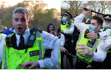 லண்டனில் வன்முறையாக மாறிய ஆர்ப்பாட்டம்! இரத்தம் சொட்ட சொட்ட கொண்டு செல்லப்பட்ட பொலிசார்: வெளியான புகைப்படம்