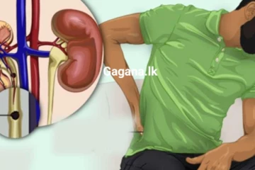 වකුගඩු රෝගයේ ලක්‍ෂණ වෙන්න පුළුවන්...ඔබ ගණන් ගන්නෙවත් නැති රෝග ලක්ෂණ හතක් මෙන්න..