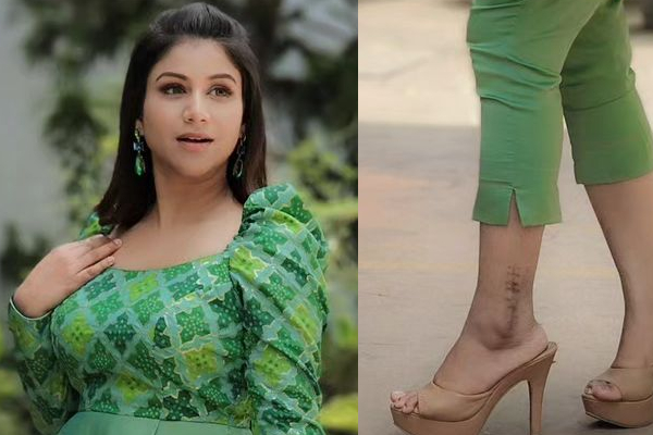 காலில் இவ்வளவு பெரிய தழும்பா!! சீரியல் நடிகை ஆல்யா மானசாவிற்கு என்ன ஆச்சு | Alya Manasa Leg Injured Scar Photo