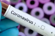 பிரதமரின் அரசியல் விவகார இணைப்புச் செயலாளருக்கு கொவிட் தொற்று உறுதி