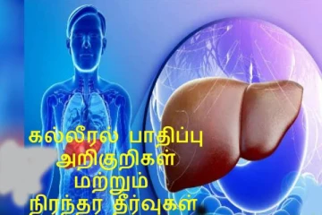 கல்லீரல் நோயின் முக்கிய அறிகுறிகள் என்னென்ன?... தடுக்கும் வழிமுறைகளுடன் இதோ...!