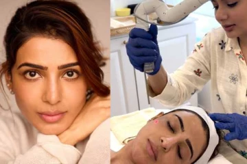 பொலிவிழந்த என் மேனி!! மயோசிடிஸ் சிகிச்சையால் சமந்தா பட்ட அவதி.. அவரே போட்டப் பதிவு