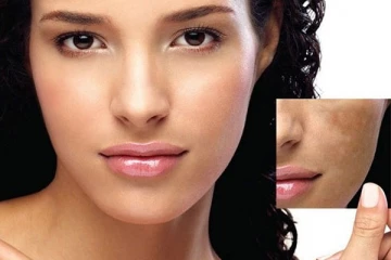 கருமையாக இருக்கும் முகத்தை பளிச்சிட செய்ய வேண்டுமா? இதோ அசத்தலான டிப்ஸ்!