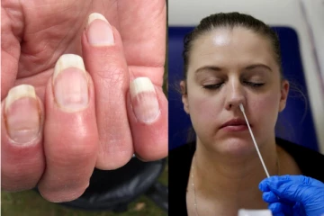 நகங்களில் வெள்ளைக் கோடு இருக்கிறதா? நீங்கள் கொரோனாவால் பாதிக்கப்பட்டிருக்கலாம்! பிரித்தானிய மருத்துவர் பரபரப்பு தகவல்