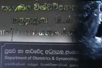 IVF முறையில் முதலாவது செயற்கை முறை கருத்தரிப்பு வெற்றி
