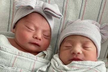அமெரிக்காவில் பிறந்த அதிசய இரட்டையர்கள் ( PHOTOS)