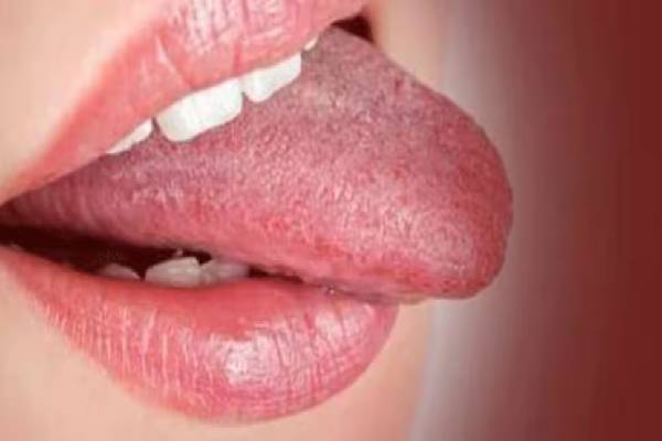 நாக்கில் இந்த அறிகுறிகள் இருக்கா? அப்போ இந்த ஆபத்து உறுதி | What Do Different Tongue Textures Mean