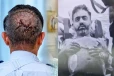 துணை விமானியின் கோடரி தாக்குதலில் சிதைந்த மண்டை ஓடு : எப்படி உயிர் தப்பினார் ஸ்மித் மச்சார்..!