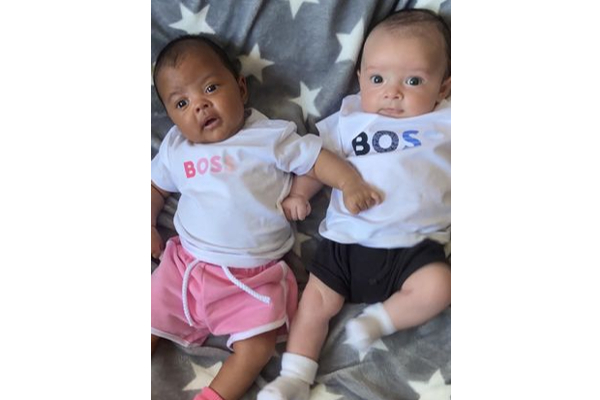 மில்லியனில் ஒருத்தருக்கு தான் இப்படி நடக்கும்! வியக்க வைத்த அபூர்வ இரட்டை குழந்தைகள் | British Nottingham Twins Born With Different Skin