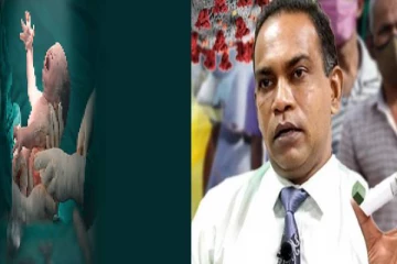 மருத்துவமனைகளில் சிசேரியன் தையலுக்கு தேவையான பொருட்களுக்கும் தட்டுப்பாடு