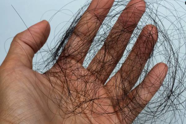 வாரம் ஒரு முறை போடுங்க.. தலைமுடி கொட்டுவது குறையும் | Home Remedies For Hair Fall In Tamil