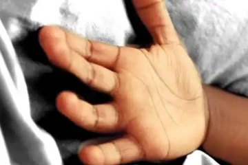 உடல் முழுவதும் சிகரெட்டால் சுடப்பட்டு நள்ளிரவில் துடித்த 2 வயது சிறுமி: பின்னணியில் அரங்கேறிய கொடுமை என்ன?