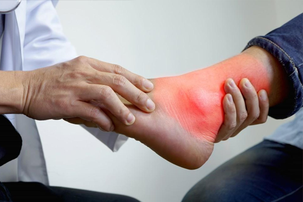 uric acid problem