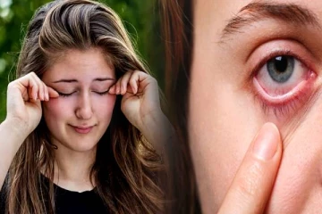 கண்களில் எரிச்சல், அரிப்பை ஏற்படுத்தும் உயிரினம் பற்றி தெரியுமா?