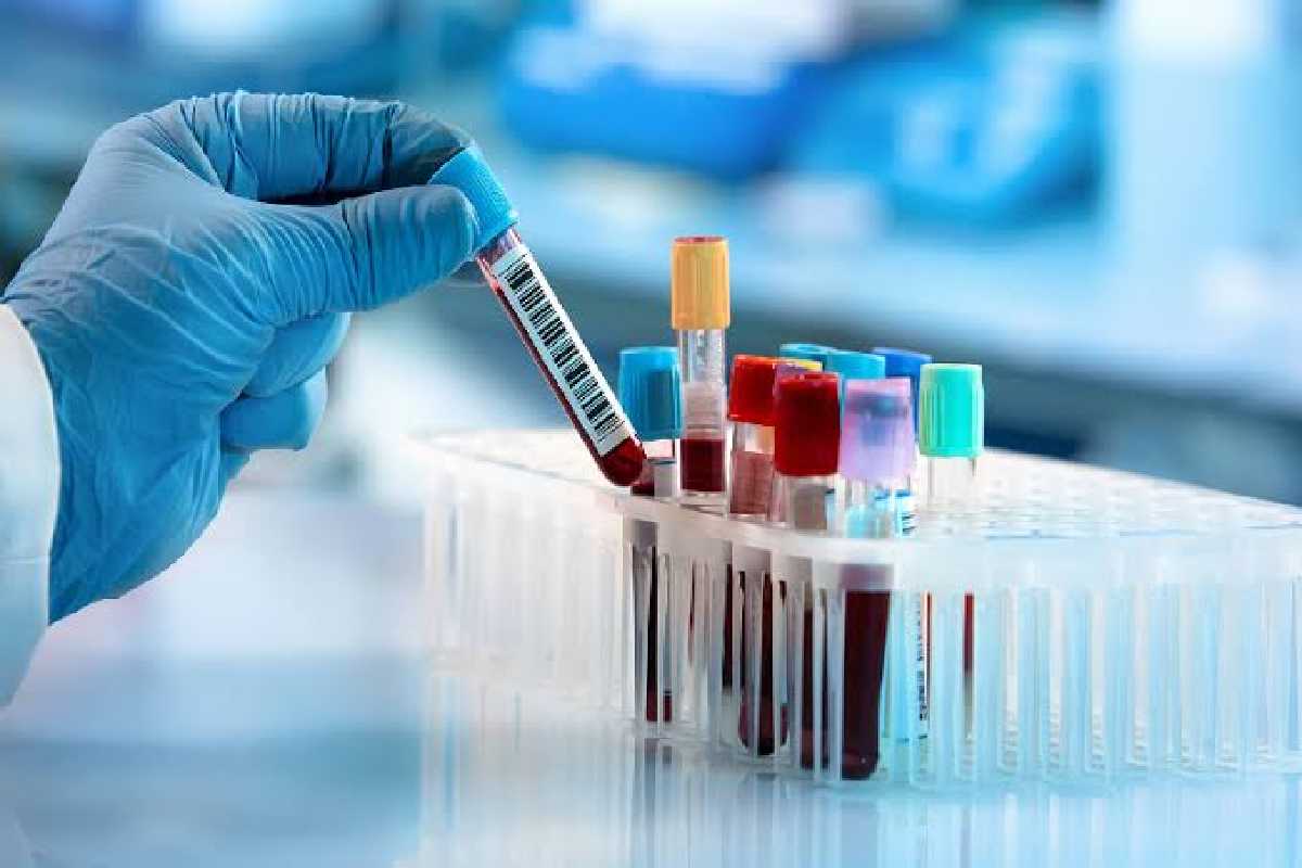 பொதுமக்களுக்கு வெளியான அறிவிப்பு : வேகமாக பரவும் மற்றுமொரு காய்ச்சல் | Rat Fever Risk Rises பொதுமக்களுக்கு வெளியான அறிவிப்பு : வேகமாக பரவும் மற்றுமொரு காய்ச்சல் | Rat Fever Risk Rises