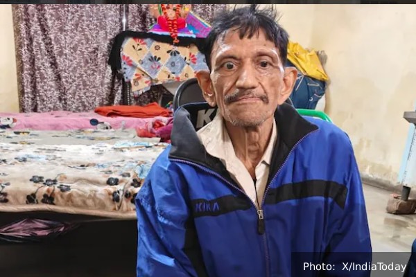 பிச்சைக்காரராக வாழ்ந்து வந்த கோடீஸ்வரர்! இந்தூர் மனிதனின் வியப்பூட்டும் சொத்து மதிப்பு | Indore Beggar Mangilal Hidden Fortune