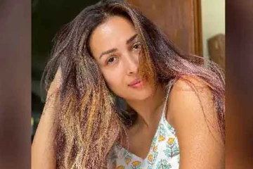 கார் விபத்தில் சிக்கிய பிரபல நடிகை - தனியார் மருத்துவமனையில் அனுமதி!