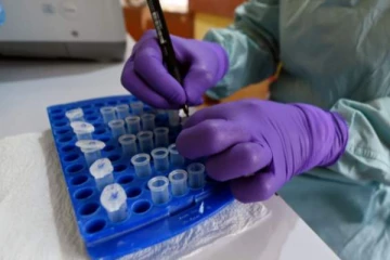 පැතිරෙන Lassa නිසා සති තුනට මරණ 26ක් - විදේශයක පැතිර යන තවත් භයානක වෛරසක්..