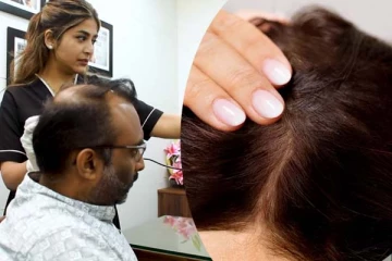 Hair Loss: முடிகொட்டும் பிரச்சனைக்கு நிரந்தர தீர்வு! வெளிநாட்டை மிஞ்சும் சிகிச்சை முறை