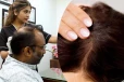 Hair Loss: முடிகொட்டும் பிரச்சனைக்கு நிரந்தர தீர்வு! வெளிநாட்டை மிஞ்சும் சிகிச்சை முறை