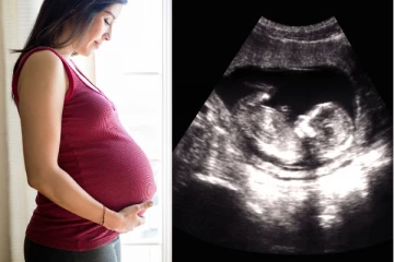 பிறக்காத குழந்தையை கணக்கு காட்டி வரி விலக்கு பெறலாம்! பிரபல நாட்டில் புதிய சட்டம்