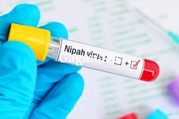 නිපා වෛරසයේ දෙවන රැල්ලක අවදානමක්.