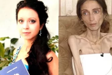 கணவர் வார்த்தையை கேட்டு டயட் இருந்த பெண்; இறுதியில் நேர்ந்த சோகம்