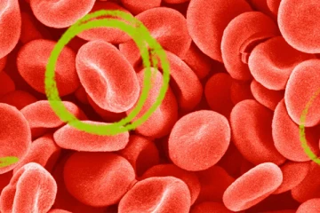 ஹீமோகுளோபின் குறைபாடா? இதனை சரி செய்ய இந்த 5 சூப்பரான பானங்களை தினமும் எடுத்துகோங்க!