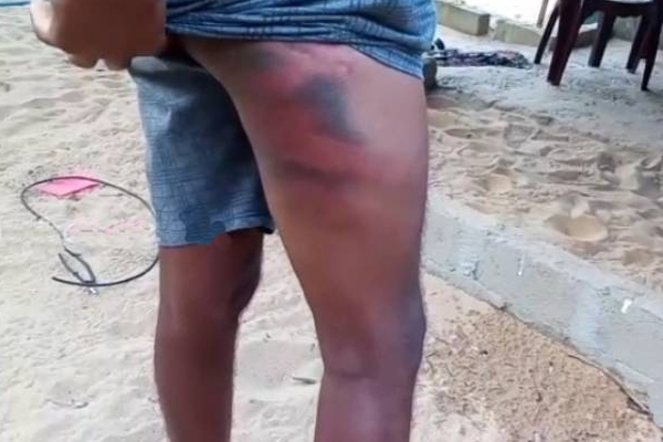 யாழில் மீனவர் ஒருவரை மூர்க்கத்தனமான தாக்கிய மர்ம நபர்கள்! | Fake Military Intelligence Attack Jaffna Fisher யாழில் மீனவர் ஒருவரை மூர்க்கத்தனமான தாக்கிய மர்ம நபர்கள்! | Fake Military Intelligence Attack Jaffna Fisher