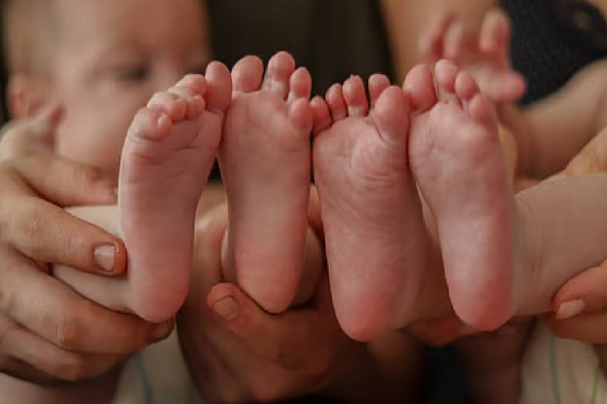 இயற்கையின் அரிய நிகழ்வு ; மாற்றான் படத்தை போல் ஒட்டி பிறந்த இரட்டை குழந்தைகள் | Twins Born Conjoined Like A Stepmother