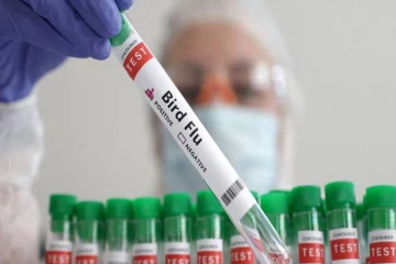 அரிய வகை பறவைக் காய்ச்சலால் பாதிக்கப்பட்ட 4 வயது ஆண் குழந்தை!