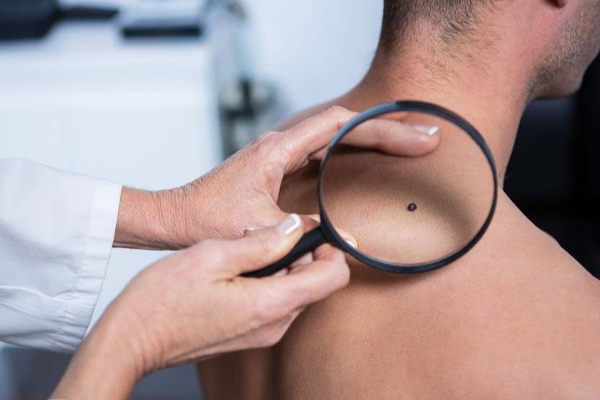 ஆண்களே... இந்த இடத்தில் இப்படி அறிகுறி இருந்தால் புற்றுநோய் தாக்கியிருக்கும் - உடனே இதை செய்யுங்கள் | Cancer Symptoms In Men