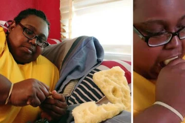 20 ஆண்டுகளாக விநோத பழக்கத்தை கொண்ட பெண்