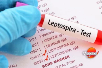 මේ ප්‍රදේශයේ දරුණු රෝගයක් උත්සන්න වෙයි - හැමෝම පරිස්සමින්