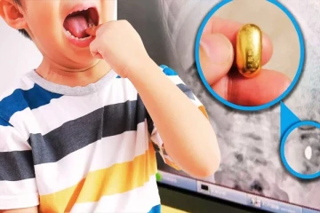 தங்கத்தை விழுங்கிய சிறுவன்... 5 நாட்கள் தவியாய் தவித்த தாய்! கடைசியில் நடந்தது என்ன?