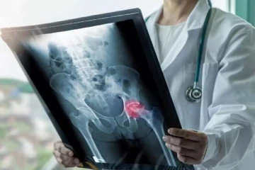 கொரோனாவிலிருந்து குணமடைந்தவர்களுக்கு ஆபத்து: அழுகும் எலும்புகள்! விசித்திரமான புதிய நோய்