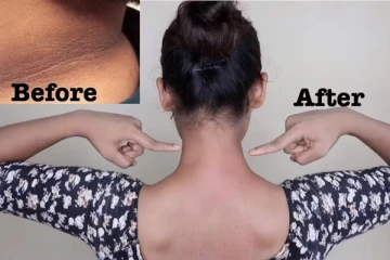 கருப்பான கழுத்தை வெள்ளையாக மாற்றும் முல்தானி மெட்டி - என்ன செய்ய வேண்டும் தெரியுமா?