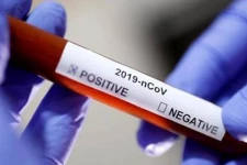 நாட்டுக்கு வருகை தந்த முதல் சுற்றுலாப் பயணிகள் குழுவில் 3 பேருக்கு கொவிட்