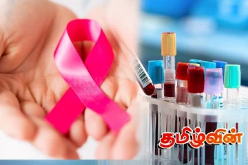 கருப்பை வாய் புற்றுநோயைக் கண்டறிய புதிய முறை