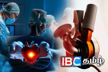 கண்டுபிடிக்கப்பட்டது செயற்கை இதயம்: வைத்தியர்கள் படைத்த புதிய சாதனை