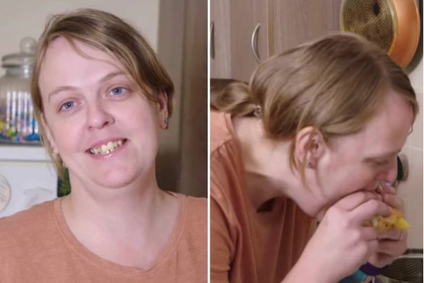 30 ஆண்டுகளாக பிரட் சீஸ் மட்டுமே உணவாக சாப்பிட்ட வினோத பெண்! வியப்பூட்டும் ஆச்சரிய சம்பவம்! | Woman 34 Eaten Vegetable 30 Years Phobia New Food